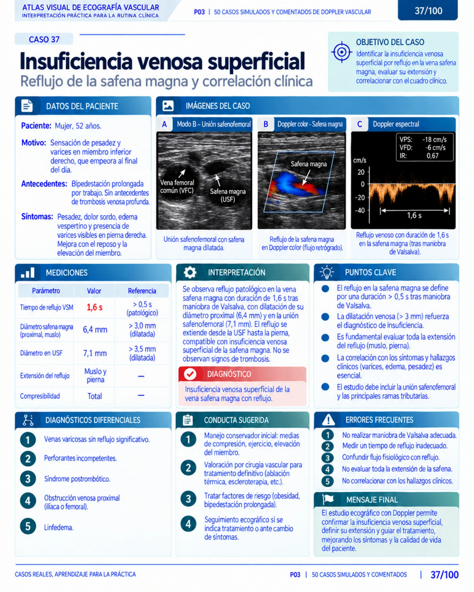 Página 37: Caso: insuficiencia venosa superficial. Muestra del material digital de Doppler vascular.
