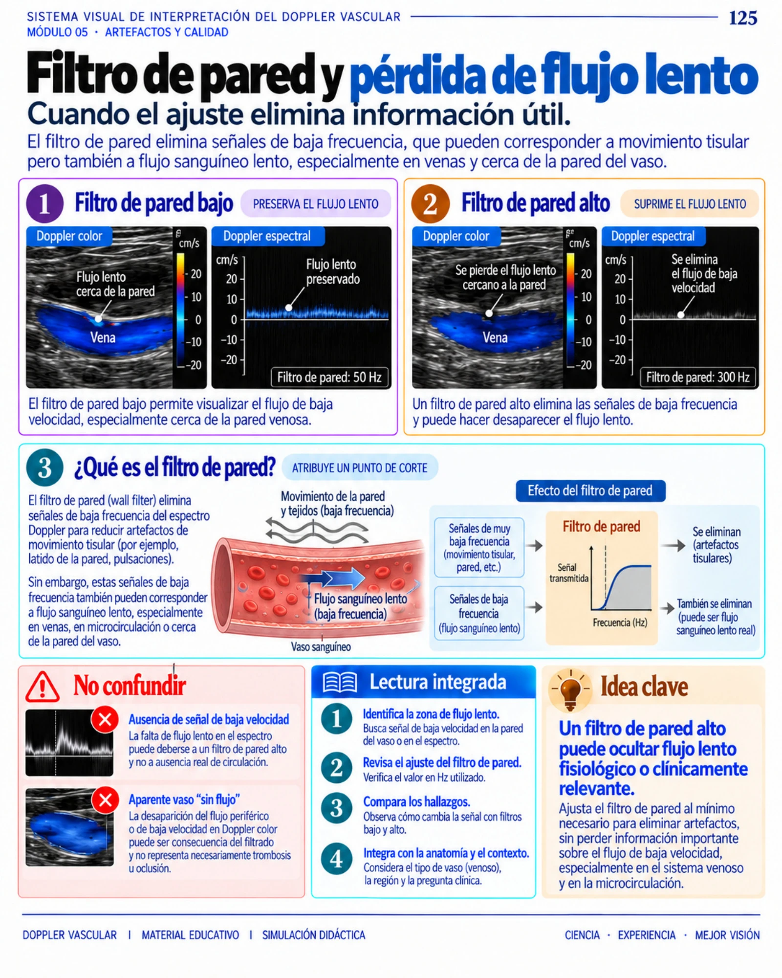 Página 125: Filtro de pared y flujo lento. Muestra del material digital de Doppler vascular.